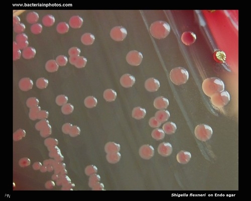 shigella on Endo